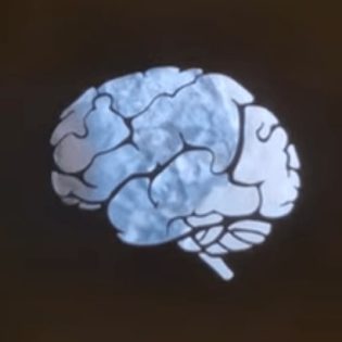 A brain on a black background